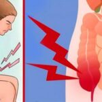 8 Early Signs of Colon Cancer, You Need To Worry About