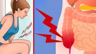 8 Early Signs of Colon Cancer, You Need To Worry About