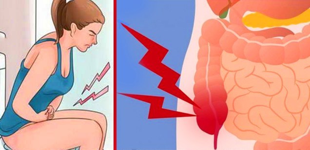 8 Early Signs of Colon Cancer, You Need To Worry About