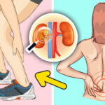 10 Early Warning Signs that your Kidneys are not working properly