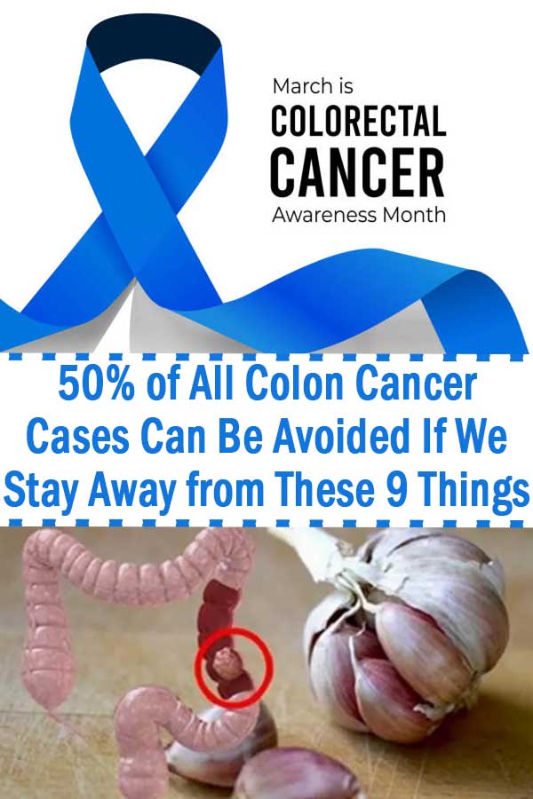 50% of All Colon Cancer Cases Can Be Avoided If We Stay Away from These 9 Things
