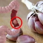 50% of All Colon Cancer Cases Can Be Avoided If We Stay Away from These 9 Things